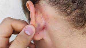 Moradora sai para vender bolachas e é agredida por pastor no centro de Três Passos